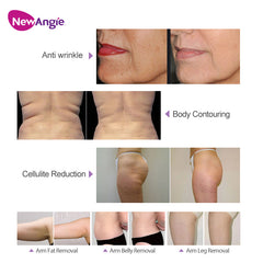 Newangie® Body Roller Machine