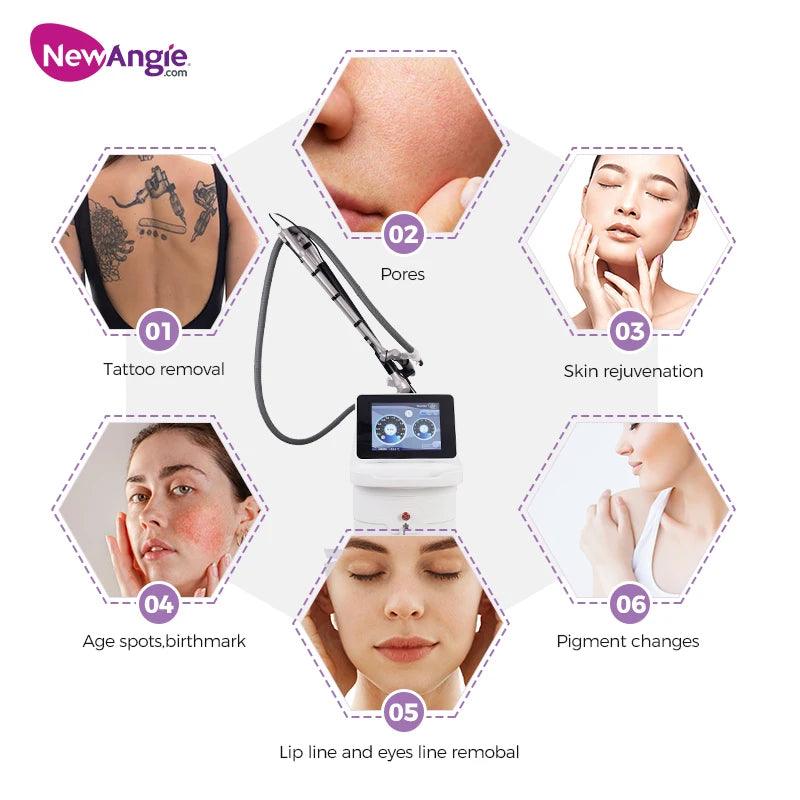 Newangie® Picosecond Laser Pigment Removal Machine - BM31.