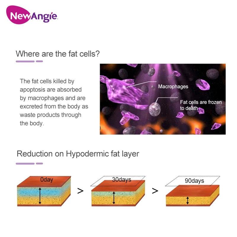 Newangie® Latest Silicone Cryo Machine - ETG50-9S.